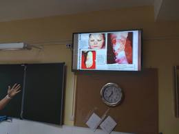 Профилактика заболеваний, передающиеся половым путём #5