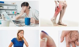 Что такое авитаминоз? #1